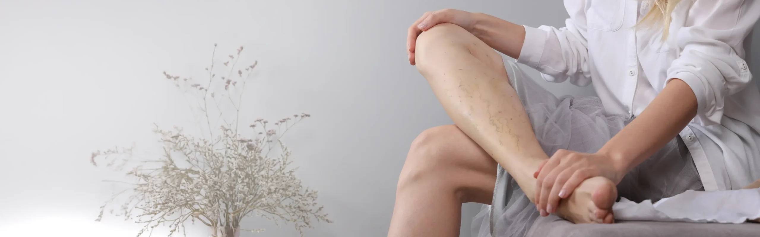 What Is Varicose Veins Treatment? Evidence-Based Care for Comfort and Confidence